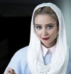 چهره جدید الناز حبیبی بعد از عمل جراحی | الناز حبیبی همه رو غافلگیر کرد